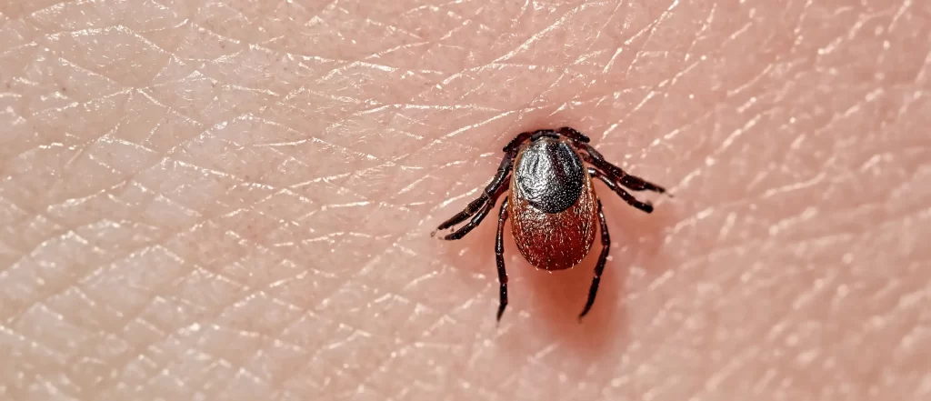 Kleszcz wbity w skórę człowieka – zbliżenie