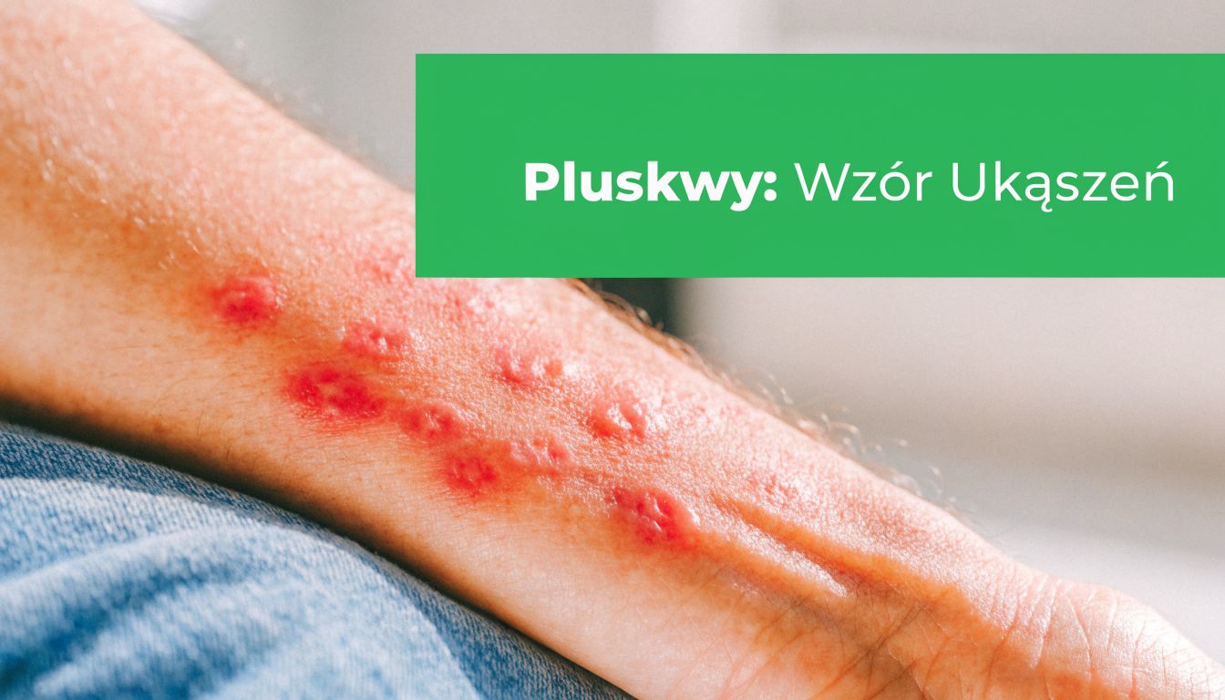 Ręka osoby z widocznymi czerwonymi śladami ugryzień pluskiew ułożonymi w charakterystyczną linię na przedramieniu.