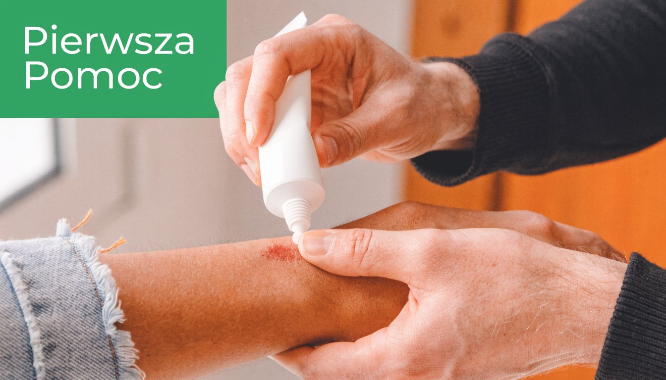 Dłoń nakłada maść z tubki na czerwoną ranę lub ślad po ugryzieniu na przedramieniu innej osoby.